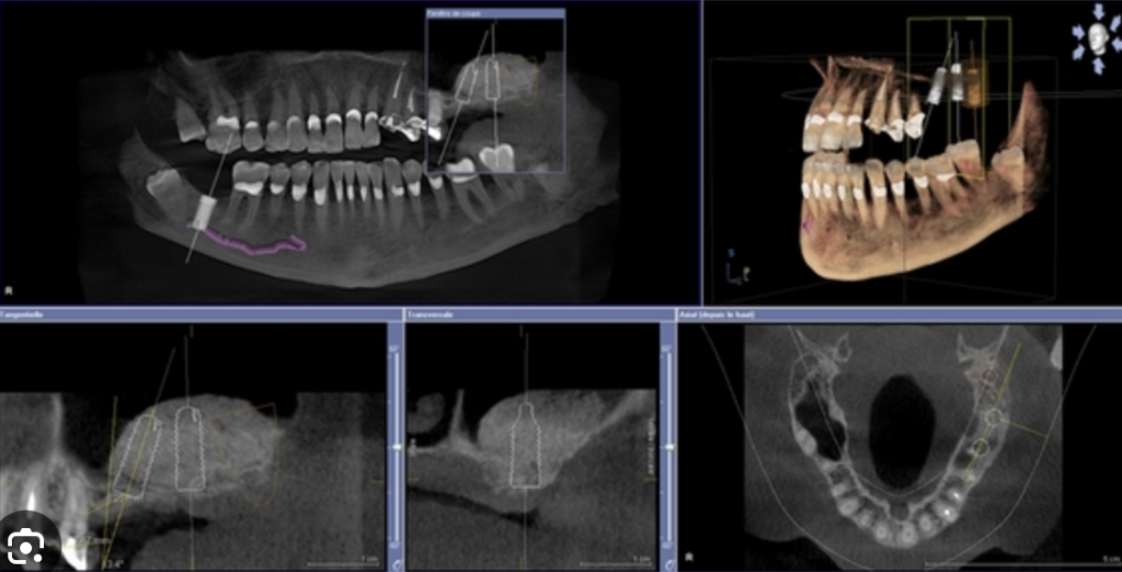 radiologie dentaire